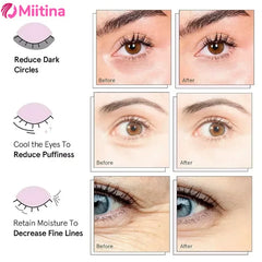 Miitina LED Microcurrent Pulse Eye Massager Relieves Eye Fatigue, Fades Dark Circles, Wrinkles, Heat Treatment,Eye Beauty Device