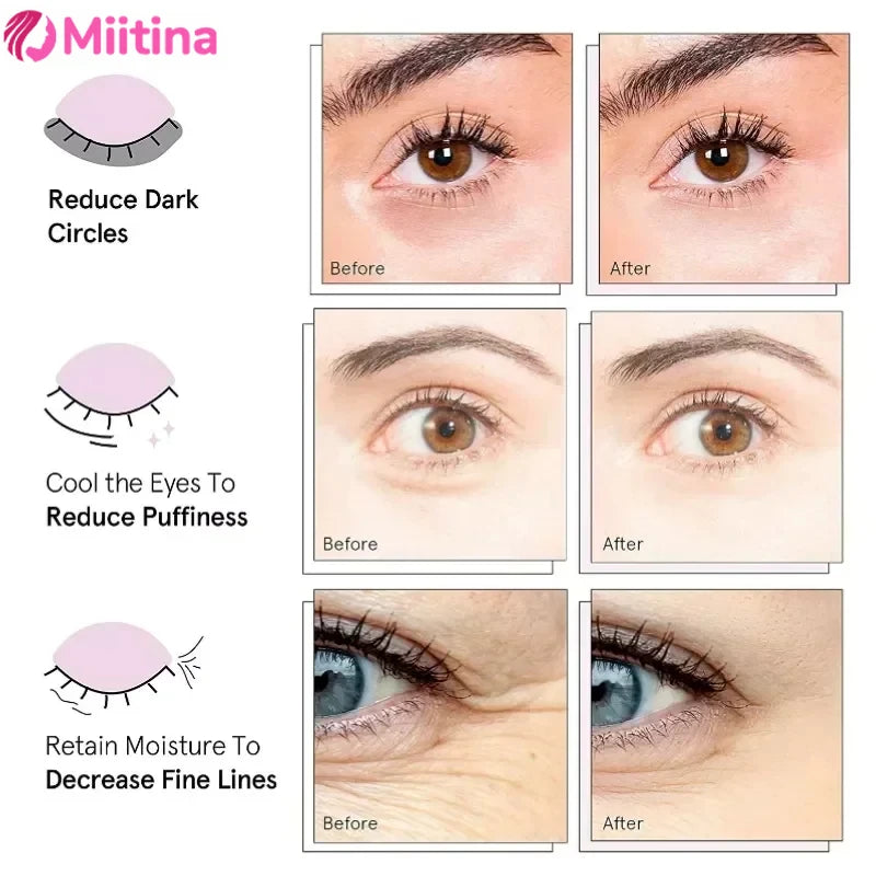 Miitina LED Microcurrent Pulse Eye Massager Relieves Eye Fatigue, Fades Dark Circles, Wrinkles, Heat Treatment,Eye Beauty Device